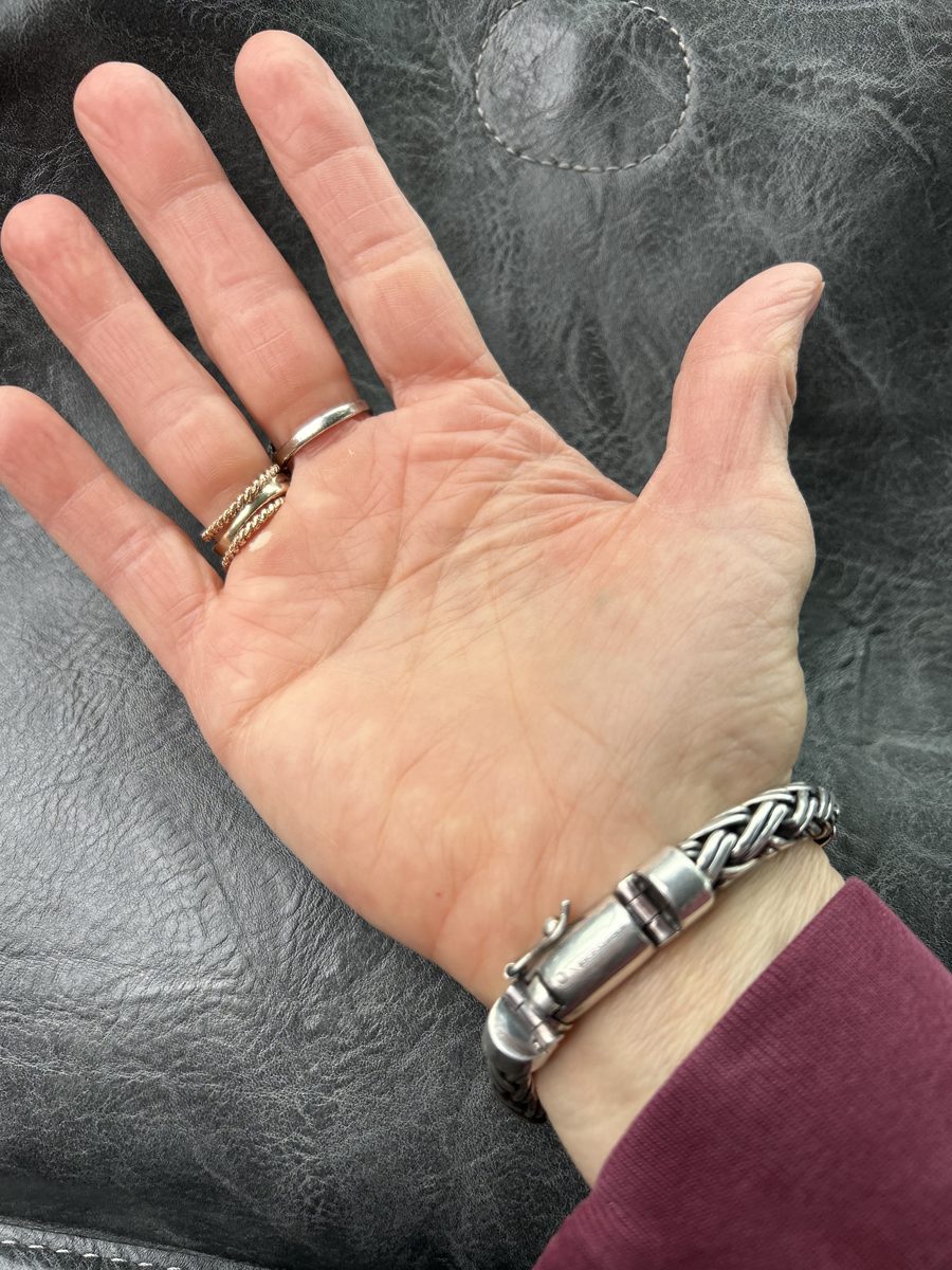 A photo Teri shared of her hand wearing a Vibershield bracelet
