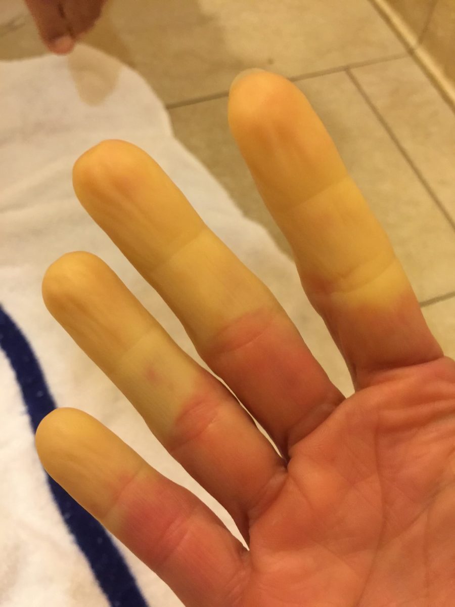 A photo Teri shared of her hand