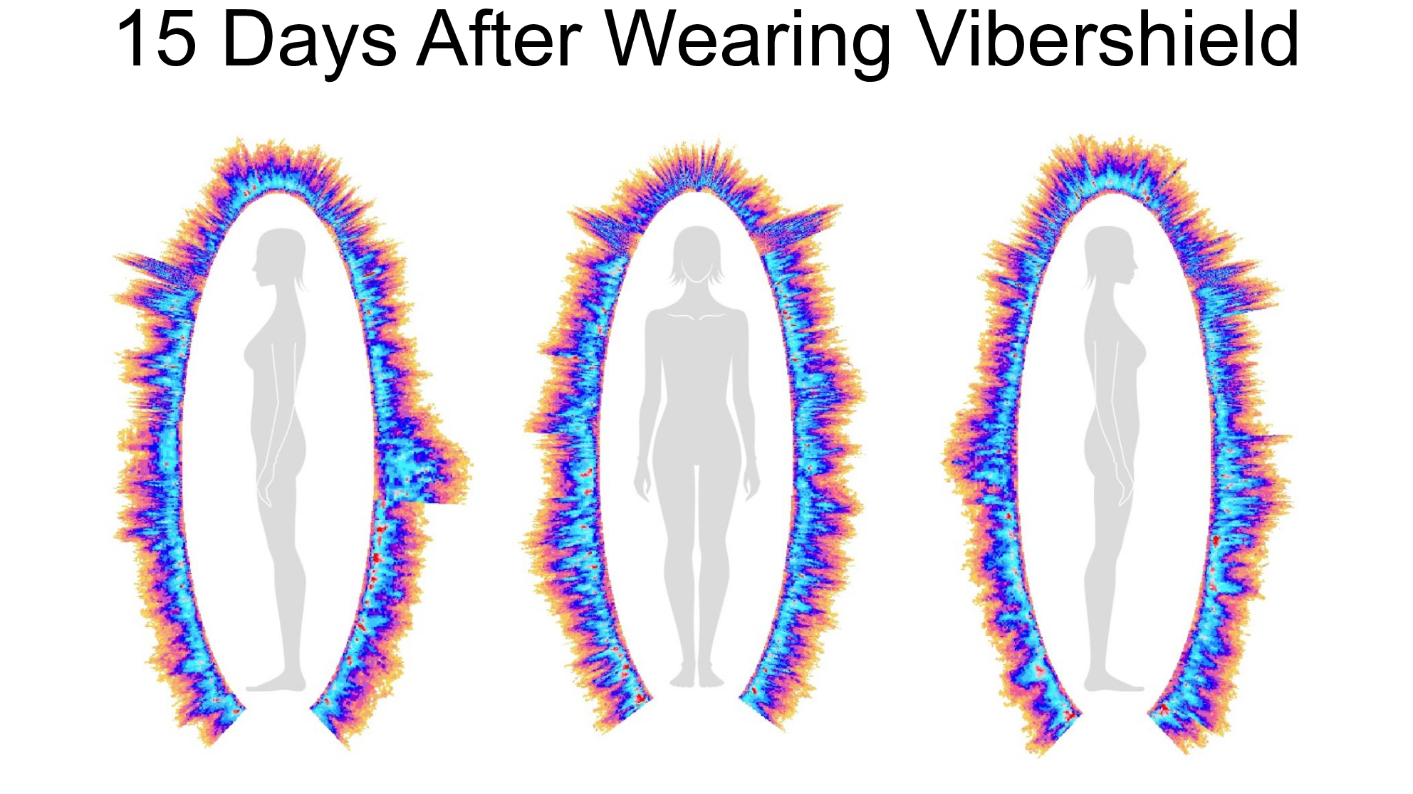 Composite biofield imaging, 15 days after wearing Vibershield