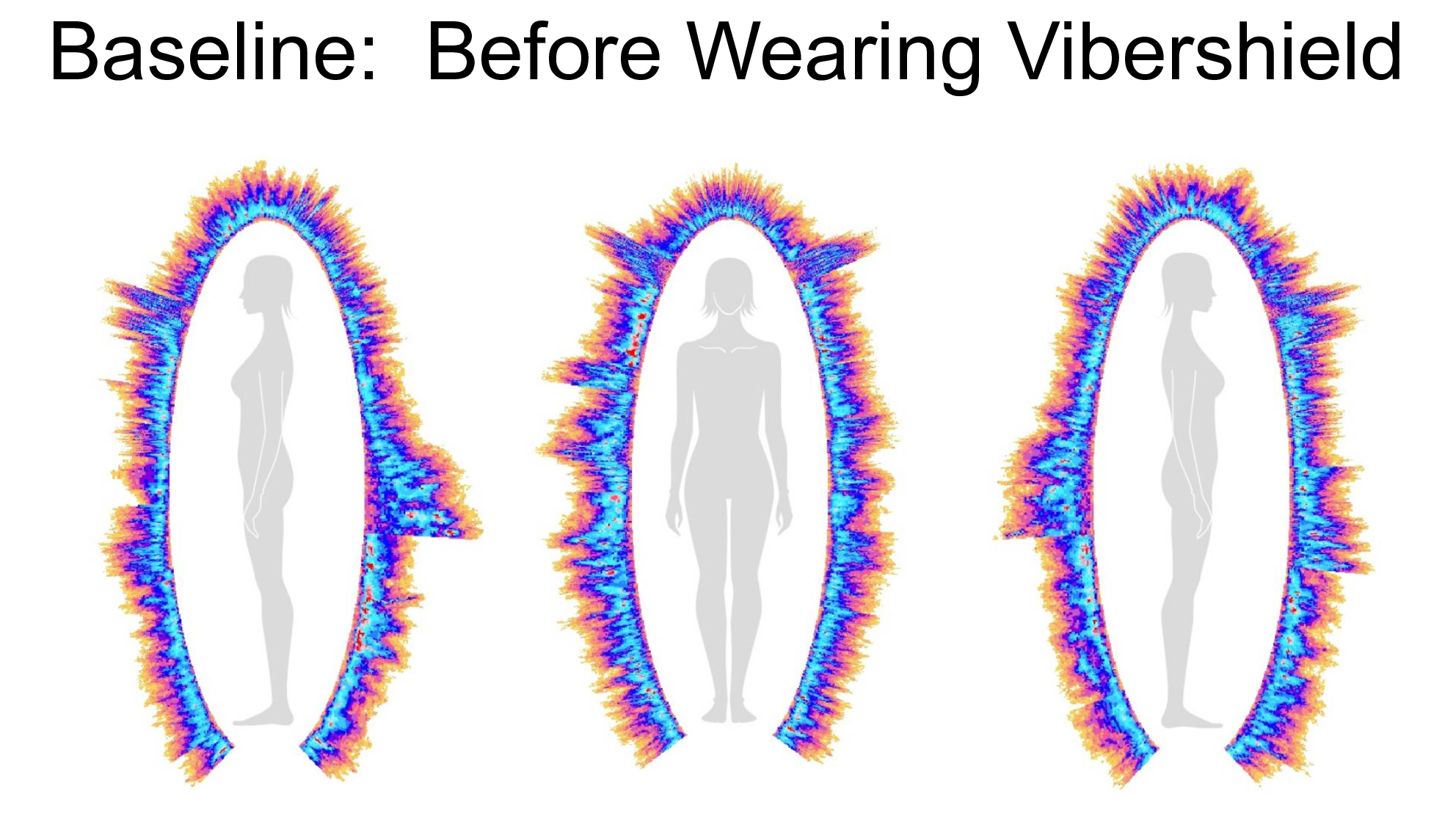 Composite biofield imaging, baseline before wearing Vibershield